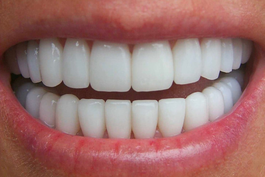 perfect teeth